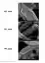 Fig. 23 - Piezoelectric-effect-induced heterogeneous electrochemical reactions