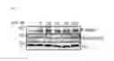Fig. 04 - COMPOUNDS AND USE FOR TREATING CANCER