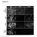 Fig. 12 - Methods and compositions for generating epicardium cells