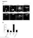 Fig. 16 - Methods and compositions for generating epicardium cells
