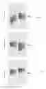 Fig. 07 - Methods of Identifying and Treating Subjects having Inflammatory Subphenotypes of Asthma