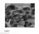 Fig. 08 - Methods of Identifying and Treating Subjects having Inflammatory Subphenotypes of Asthma