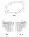 Fig. 04 - Electroplating apparatus with notch adapted contact ring seal and thief electrode