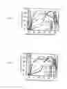 Fig. 33 - Method of crystallization in aqueous plugs flowing in immiscible carrier-fluid in microfluidic system