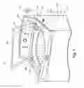 Fig. 06 - Household cleaning appliance with a dispensing system operable between a single use dispensing system and a bulk dispensing system