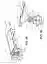 Fig. 04 - Adjustment device