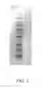 Fig. 06 - ELECTROPHORESIS BUFFER FOR FASTER MIGRATION, IMPROVED RESOLUTION AND EXTENDED SHELF-LIFE