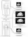 Fig. 01 - METHOD AND SYSTEM FOR AUTOMATIC DEFORMABLE REGISTRATION