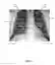 Fig. 08 - PACS viewer and a method for identifying patient orientation