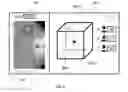 Fig. 09 - Method of processing X-ray images of a breast