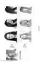 Fig. 17 - Computer implemented methods and systems for generating virtual body models for garment fit visualisation
