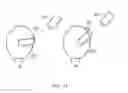 Fig. 09 - Image processing