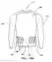 Fig. 30 - Garment with compression adjustment arrangement