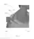 Fig. 07 - RECOVERY GARMENT