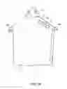 Fig. 02 - MEDICAL GARMENT WITH TRANSPARENT WINDOW