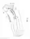 Fig. 04 - MEDICAL GARMENT WITH TRANSPARENT WINDOW