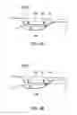 Fig. 06 - MEDICAL GARMENT WITH TRANSPARENT WINDOW