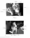 Fig. 08 - TRAY FOR HOLDING EYELASH EXTENSIONS AND PROCESSES FOR APPLYING EYELASH EXTENSIONS