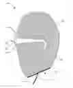 Fig. 01 - Protective Hood