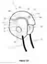Fig. 03 - Emergency Head Covering Cold Pack for Head Trauma, Concussions, Wounds or Migraines