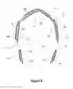 Fig. 05 - Emergency Head Covering Cold Pack for Head Trauma, Concussions, Wounds or Migraines