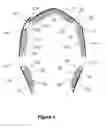 Fig. 06 - Emergency Head Covering Cold Pack for Head Trauma, Concussions, Wounds or Migraines