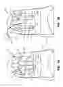 Fig. 09 - Lace engaging structures and other features for articles of footwear and other foot-receiving devices