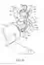 Fig. 09 - Tissue resecting system