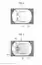 Fig. 05 - Ophthalmologic apparatus, image processing method, and medium