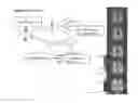 Fig. 01 - Imaging reductions in cerebrovascular reactivity