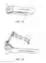 Fig. 02 - BIOLOGICAL INFORMATION MEASURING APPARATUS