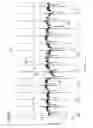 Fig. 08 - Detection of R-peak point in an electrocardiogram signal