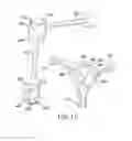 Fig. 11 - REFERENCE DEVICE FOR SURGICAL NAVIGATION SYSTEM