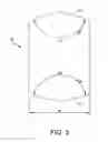 Fig. 04 - Trochlea-angle measurement template
