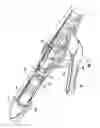Fig. 07 - SURGICAL INSTRUMENT WITH MAGNETIC SENSOR