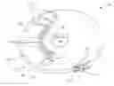 Fig. 01 - Apparatus for eliciting a blood sample