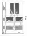 Fig. 17 - SEM scanner sensing apparatus, system and methodology for early detection of ulcers