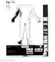 Fig. 28 - Device and method for evaluating analgesic neurostimulation devices