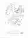 Fig. 04 - Uni-planer bone fixation assembly
