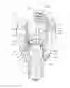 Fig. 14 - Uni-planer bone fixation assembly