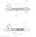 Fig. 02 - Retractable inflatable bone tamp