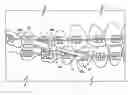 Fig. 01 - ORTHODONTIC BITE CORRECTOR