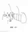 Fig. 06 - ORTHODONTIC BITE CORRECTOR