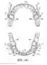 Fig. 07 - ORTHODONTIC BITE CORRECTOR