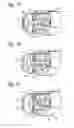 Fig. 07 - HYDRAULIC URETHRAL OCCLUSIVE DEVICE