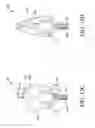 Fig. 13 - HYDRAULIC URETHRAL OCCLUSIVE DEVICE