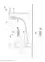 Fig. 15 - HYDRAULIC URETHRAL OCCLUSIVE DEVICE