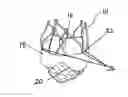 Fig. 01 - VASCULAR IMPLANT