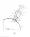 Fig. 06 - BALLOON VALVULOPLASTY DELIVERY SYSTEM