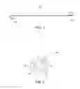 Fig. 02 - Ureteral stent